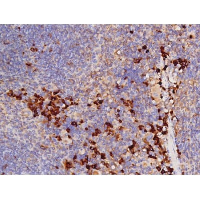 Polyclonal Rabbit anti-Human MAPT / Tau Antibody (phospho-Thr212, IHC, WB)