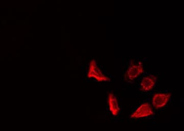 ARTS1 / ERAP1 Antibody