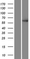 SMEK2 Protein (Over-Expression Lysate Myc-DDK (Flag))