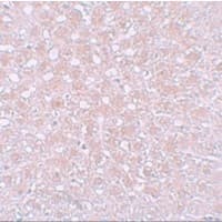 Polyclonal Rabbit anti-Human Alpha-Fetoprotein Antibody (IHC, IF, WB)