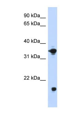 GPD1 Antibody (aa251-300)