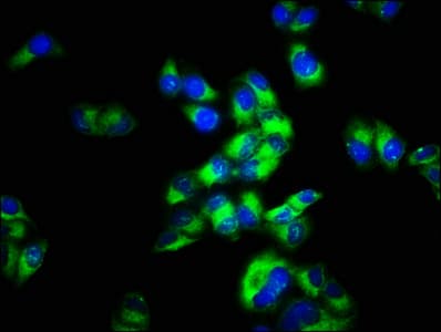 MCHR2 Antibody