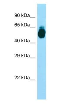 Polyclonal Rabbit anti-Human GIPR / GIP Receptor Antibody (aa97-146, WB)