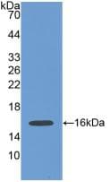 POSTN / Periostin Antibody (aa97-230)