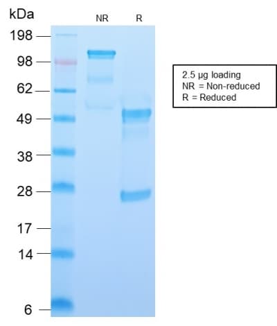 PathPlus™ Recombinant Monoclonal Rabbit anti-Human CD34 Antibody (clone HPCA1/2598R, IHC)