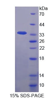 Bovine IL-1B / IL-1 Beta Protein (Recombinant His-T7)