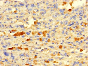 Polyclonal Rabbit anti-Human IFI27L2 Antibody (IHC, IF)