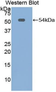 MSLN / Mesothelin Antibody (aa400-615)