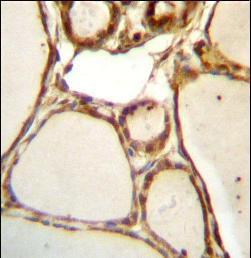 Polyclonal Rabbit anti-Human HJURP Antibody (aa559-588, IHC, WB)