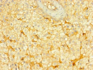 Polyclonal Rabbit anti-Human ENTPD3 Antibody