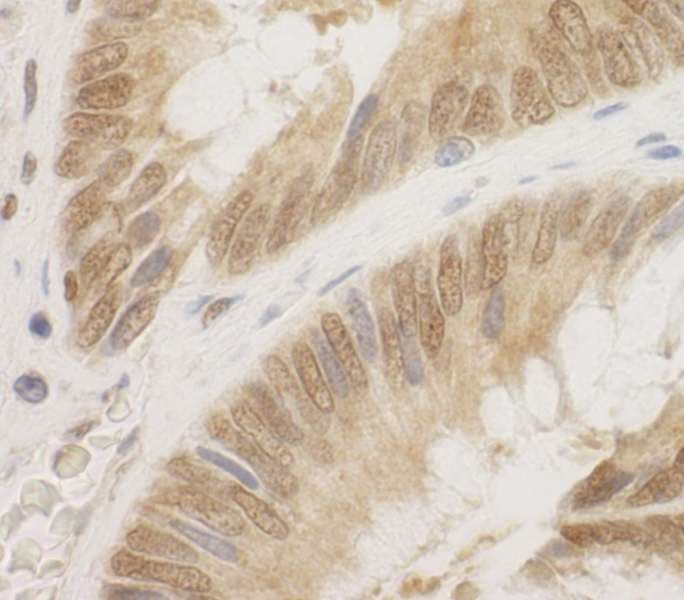 CDC6 Antibody (aa1-50)