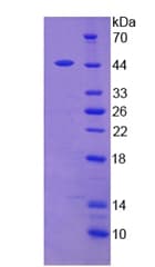Human Leptin Protein (Recombinant His-GST, N-terminus)