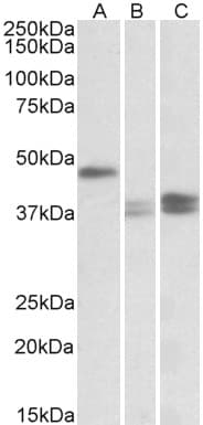 IHC-plus™ TXNDC5 / ERP46 Antibody (aa269-282)
