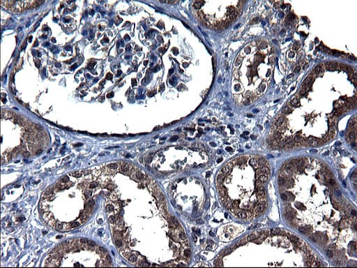 TXNDC5 / ERP46 Antibody (clone OTI2E6)
