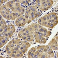 QCR2 / UQCRC2 Antibody