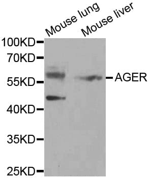 AGER / RAGE Antibody