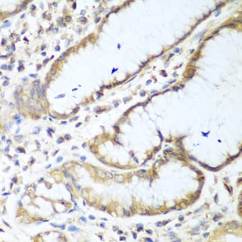 NUDT15 Antibody