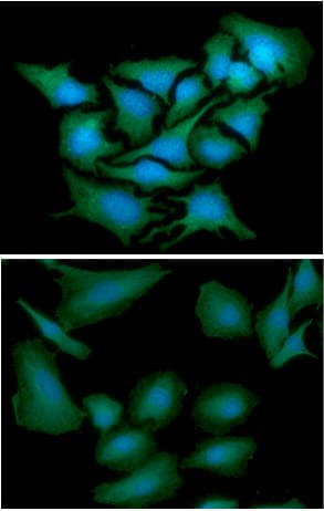 Monoclonal Mouse anti-Human DNAL1 Antibody (clone AT29E4, WB)
