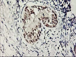 SERPINB13 / HUR7 Antibody (clone OTI2B6)