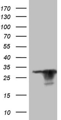 KCNIP2 / KCHIP2 Antibody (clone OTI14A7, Carrier-free)