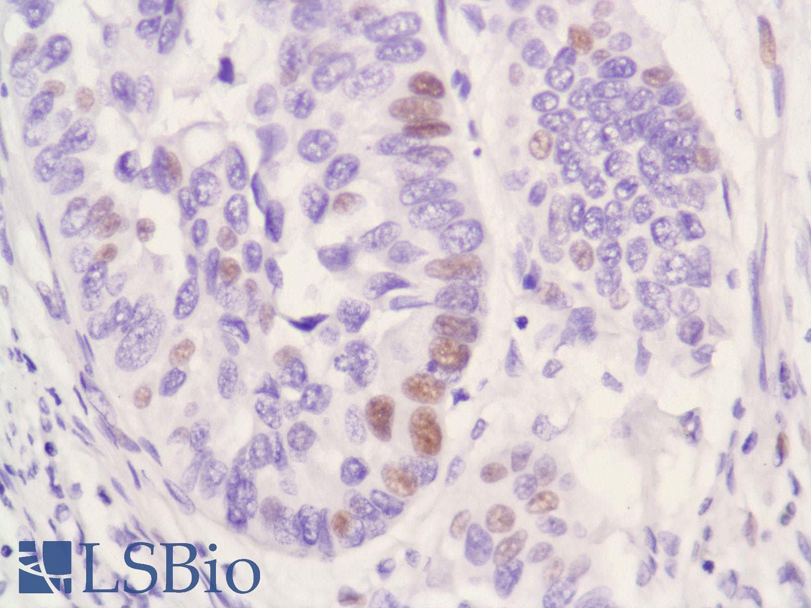 Monoclonal Rabbit anti-Human AR / Androgen Receptor Antibody (clone SP107, N-Terminus, IHC)