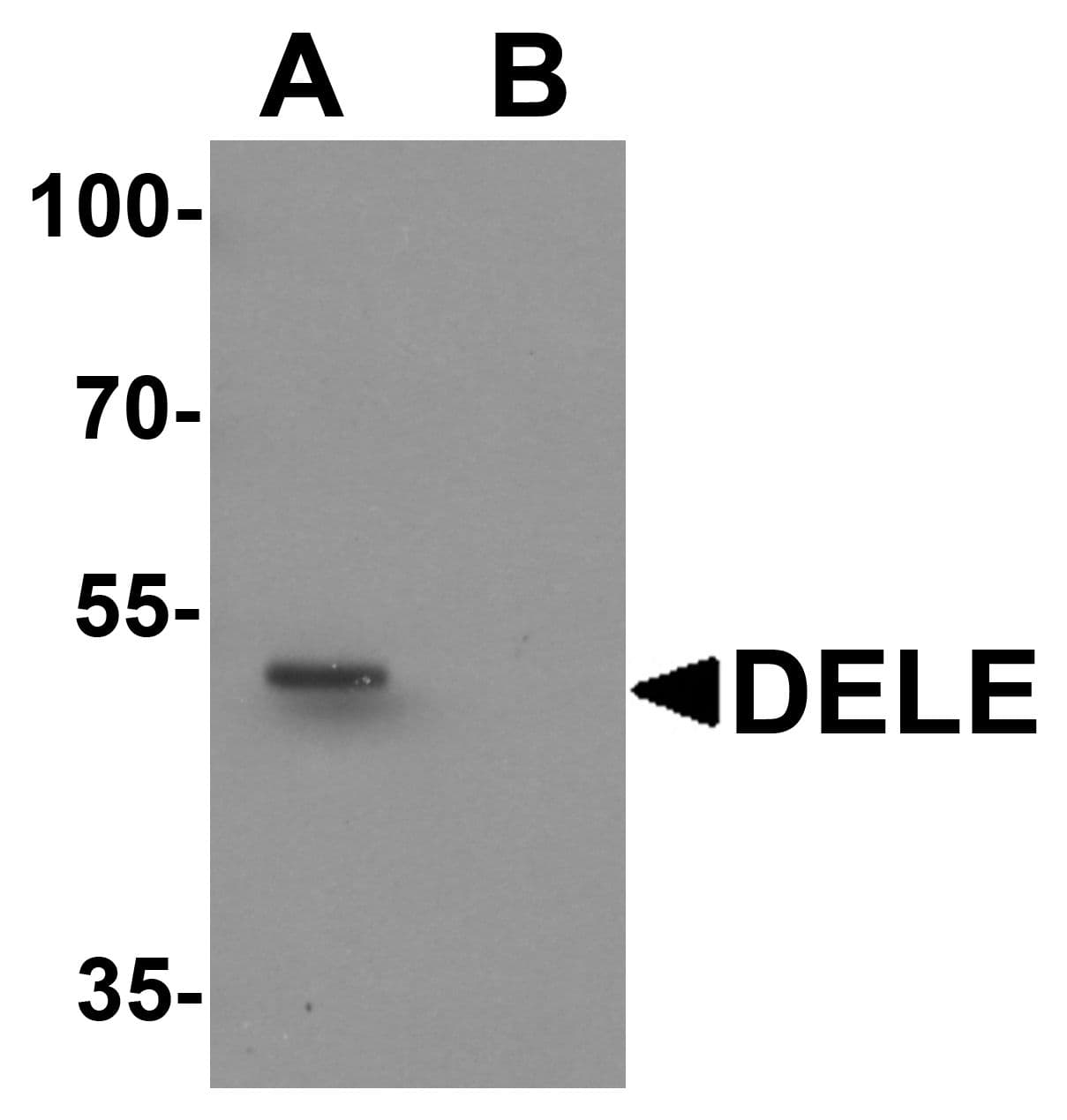 IHC-plus™ KIAA0141 Antibody