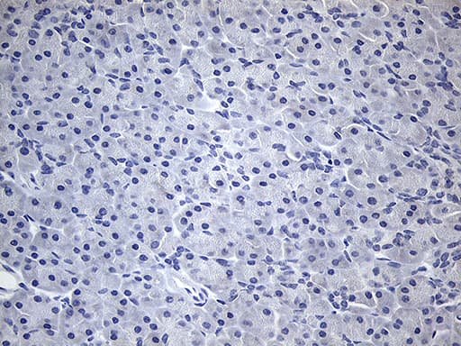 TG / Thyroglobulin Antibody (aa20-358, clone OTI2B9)