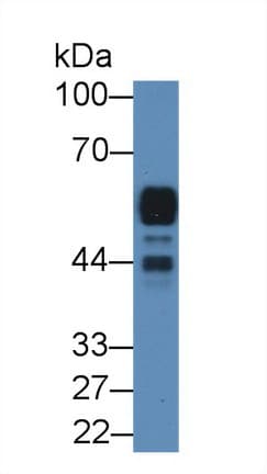 AMY2A / Pancreatic Amylase Antibody (aa201-473)