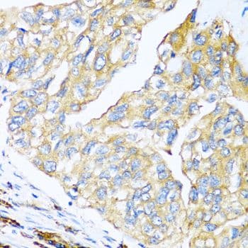 MANF / ARMET Antibody
