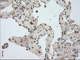 BUB1B / BubR1 Antibody (clone OTI3C7)
