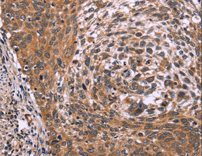 Polyclonal Rabbit anti-Human ING2 Antibody (IHC)