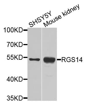 RGS14 Antibody