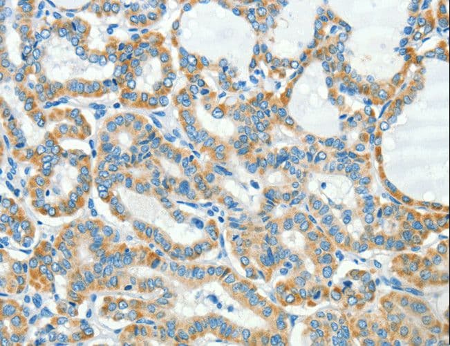 Polyclonal Rabbit anti-Human L1CAM Antibody (IHC)