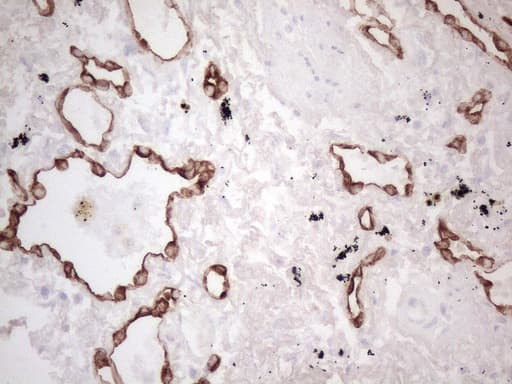 KRT16 / CK16 / Cytokeratin 16 Antibody (clone OTI2H8)
