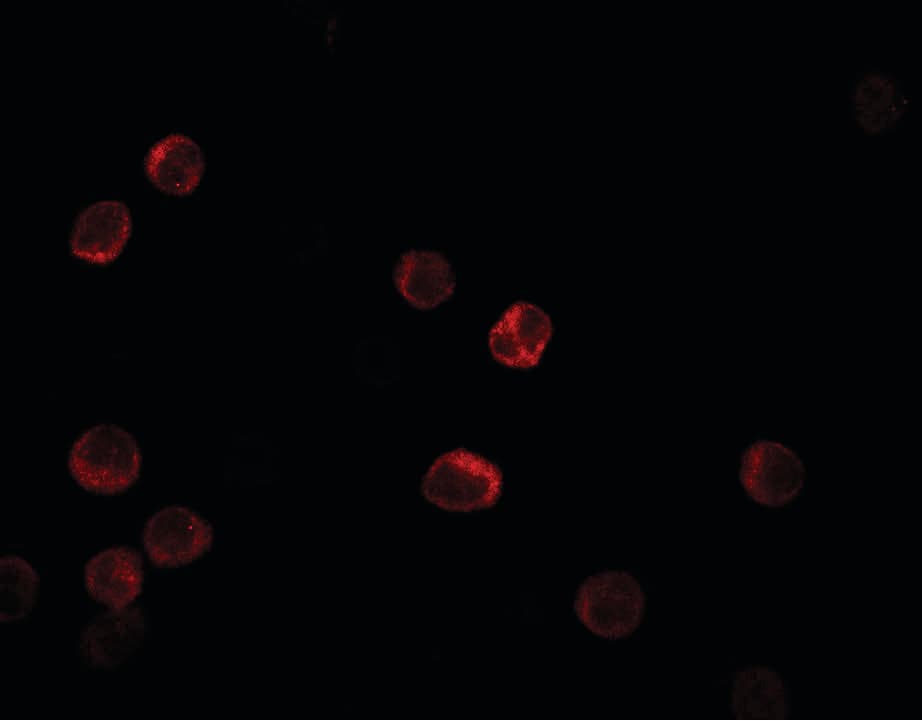 IL28B Antibody