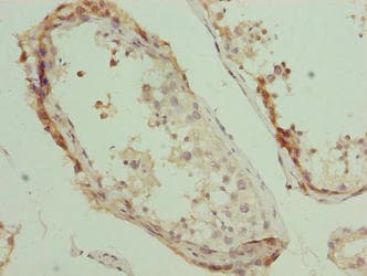 PLEKHJ1 Antibody