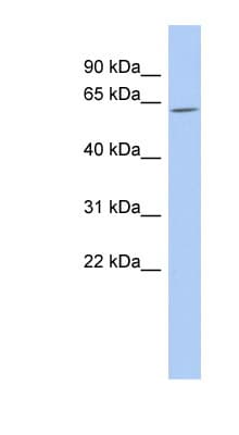 Polyclonal Rabbit anti-Human TULP2 Antibody (aa323-372, WB)