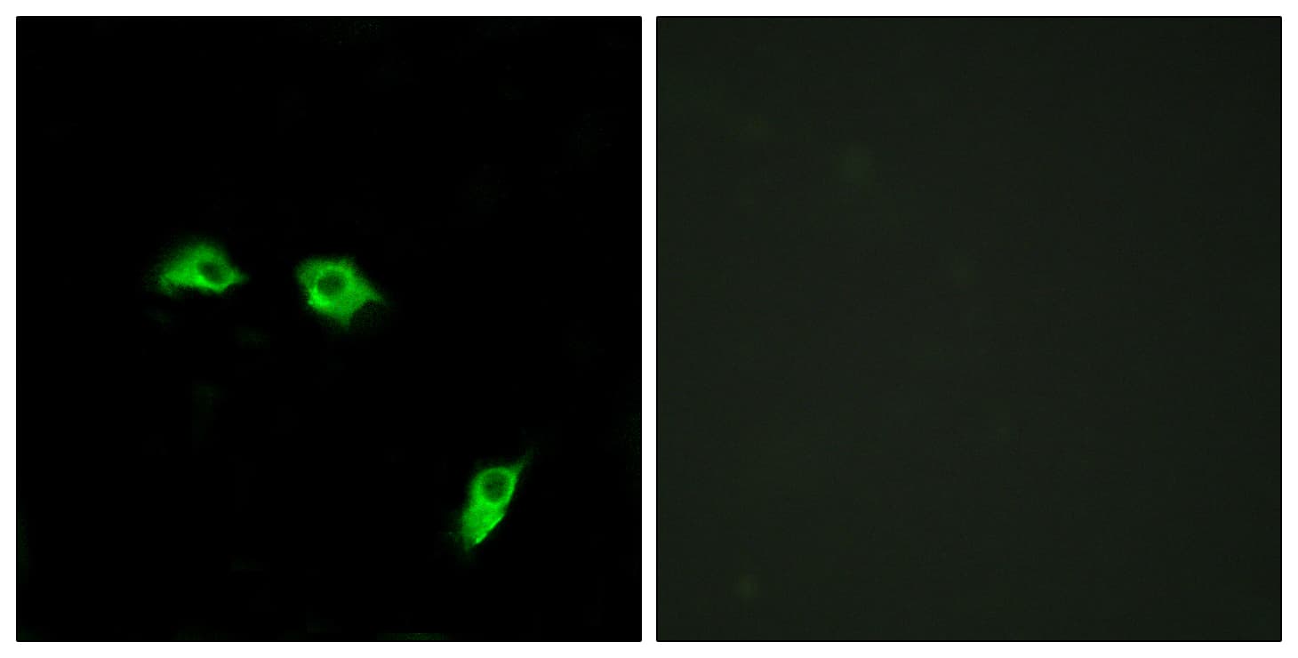 Polyclonal Rabbit anti-Human GABBR1 / GABA B Receptor 1 Antibody (aa891-940, IF, WB)