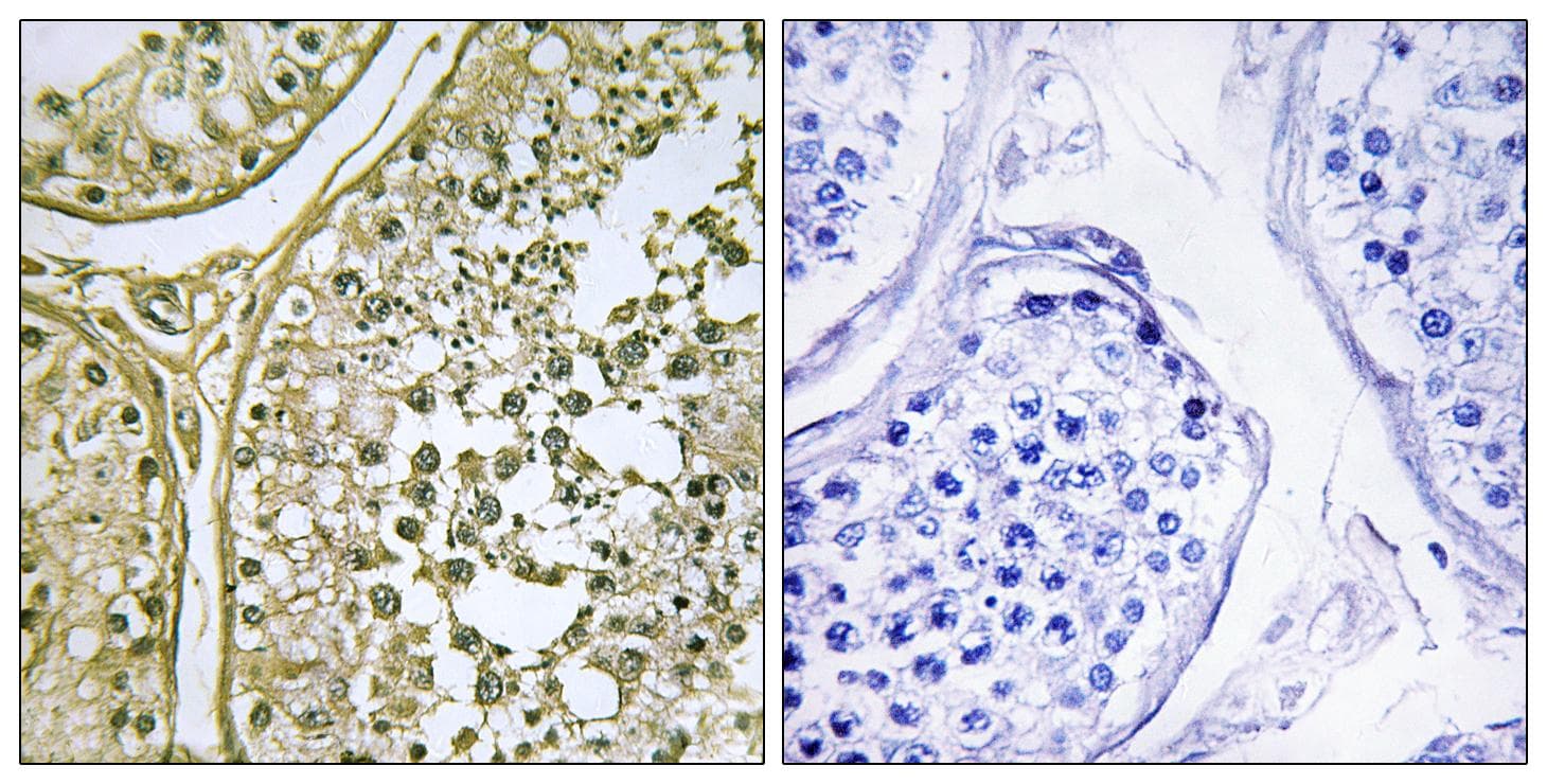 CSNK1A1L Antibody