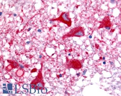 PathPlus™ OR6N1 Antibody (Extracellular Domain)