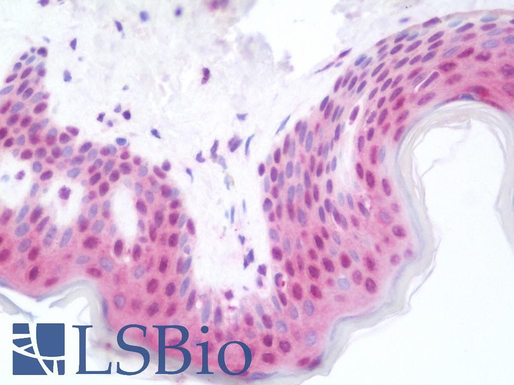 IHC-plus™ Polyclonal Rabbit anti-Human RAD23B / HR23B Antibody (IHC, IF, WB)
