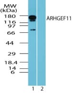IHC-plus™ Polyclonal Rabbit anti-Human ARHGEF11 Antibody (aa1-50, IHC, WB)