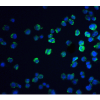 IHC-plus™ Polyclonal Rabbit anti-Human REEP3 Antibody (IHC, IF, WB)