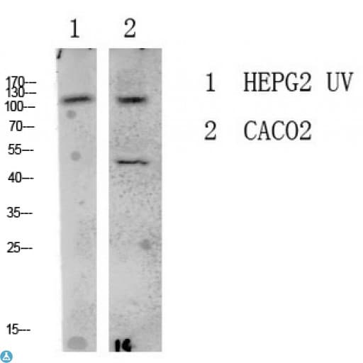 LATS1 + LATS2 Antibody