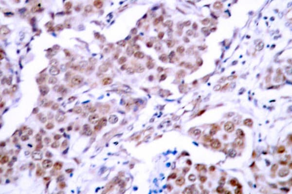 TP53 / p53 Antibody (phospho-Ser15)