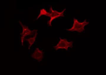 Polyclonal Rabbit anti-Human BCL2L1 / BCL-XL Antibody (phospho-Thr47, IHC, IF, WB)