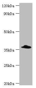 Polyclonal Rabbit anti-Human CFHR3 / CFHL3 Antibody (aa80-200, WB)