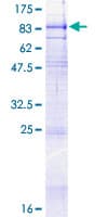 Human SLC34A1 / NPT2 Protein (Recombinant GST)