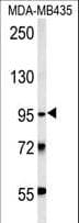 TRHDE Antibody (aa951-980)