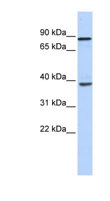 Polyclonal Rabbit anti-Human DHX35 Antibody (N-Terminus, WB)